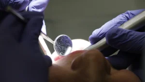 a closeup view of a dental examination